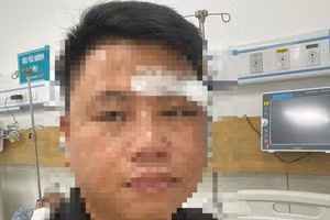 Luật sư Đ. bị thương ở khuôn mặt sau khi bị nhóm người lạ hành hung. 