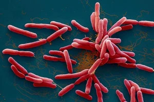 Bệnh Whitmore do vi khuẩn Burkholderia pseudomallei gây ra.