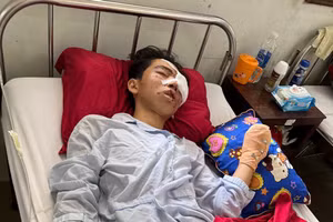 Em Võ Tuấn Tú bị dập tay, hỏng mắt sau vụ tai nạn nổ bình ga mini.