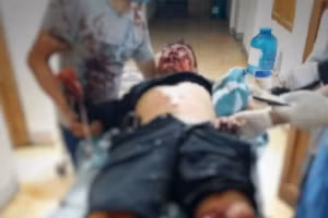 Hà Tĩnh: Nam thanh niên bị mất bàn tay sau vụ nổ lớn