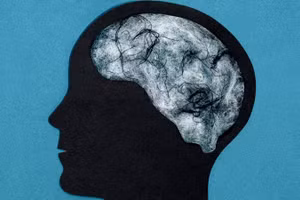 Tác động của Covid-19 đến não