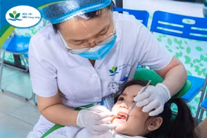 Có 4 giai đoạn phát triển của sâu răng. Ảnh minh họa