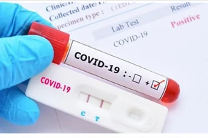 Độ nhạy của test nhanh phụ thuộc vào nồng độ virus, nhưng kém nhạy hơn PCR.