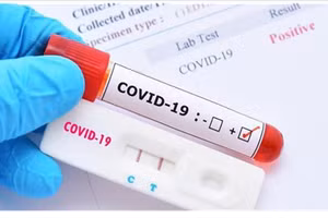 Độ nhạy của test nhanh phụ thuộc vào nồng độ virus, nhưng kém nhạy hơn PCR.