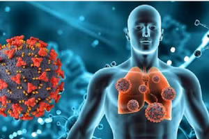 (Ảnh minh họa: Internet)