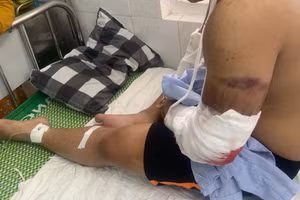 Shipper Đạt đang được điều trị tại Bệnh viện Quân y C17 (Đà Nẵng).