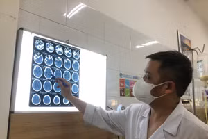 Bác sĩ Nguyên đánh giá mức độ tổn thương não của bệnh nhân ngộ độc methanol. Ảnh: BVCC.