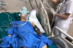 Bệnh nhân cấp cứu do thuốc lào. Ảnh: BVCC