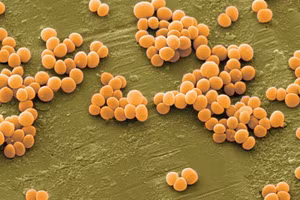 Khi thực phẩm tiếp xúc với tụ cầu khuẩn, vi khuẩn sẽ nhân lên và tạo ra độc tố. 