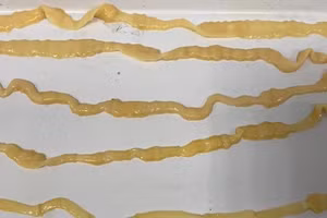 Viện Sốt rét - Ký sinh trùng - Côn trùng Trung ương cho biết, trung bình mỗi ngày, phát hiện khoảng 3 đến 5 trường hợp nhiễm sán. Ảnh minh họa sán. 