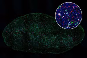 Việc kích hoạt tế bào T điều hòa được thúc đẩy bởi nồng độ interferon gamma cao trong hạch bạch huyết. 