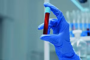 Cục Quản lý Thực phẩm và Dược phẩm Mỹ (FDA) đã chấp thuận sử dụng tế bào CAR-T cho một số loại ung thư. Ảnh minh họa