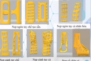 Nẹp chấn thương chỉnh hình bằng công nghệ in 3D mà nhóm nghiên cứu đã hoàn thiện.