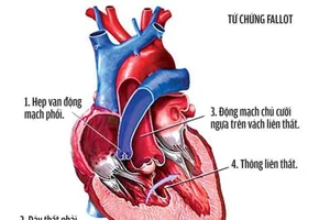 Ảnh minh họa: ITN