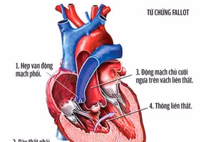 Ảnh minh họa: ITN