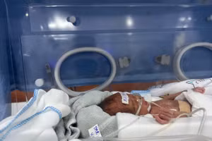 Thời gian đầu, trẻ gặp nhiều khó khăn nên được chăm sóc đặc biệt. Ảnh: BVCC.