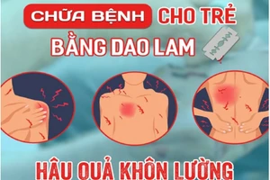 Dùng dao lam nặn (hoặc rạch) lấy máu để chữa bệnh là phương pháp hoàn toàn không có tính khoa học. Ảnh minh họa