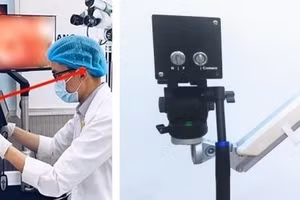 Thiết bị nội soi tử cung của nhà khoa học Việt.