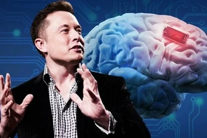 Neuralink là một công ty công nghệ thần kinh của Mỹ được thành lập bởi tỷ phú Elon Musk.