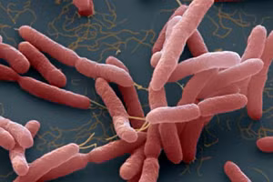 Whitmore là căn bệnh truyền nhiễm khó phát hiện do dễ nhầm lẫn với bệnh khác. Ảnh minh họa 