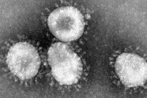 Mỹ: Các nhân viên phòng thí nghiệm suýt làm lây lan virus chết người