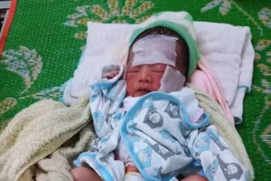 Cháu bé sơ sinh bị bỏ rơi ngoài rẫy bắp.