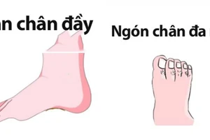 Tướng bàn chân phụ nữ cả đời hưởng trọn vinh hoa phú quý