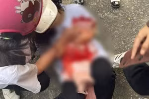 Nữ sinh bị bạn dùng dao đâm trọng thương.