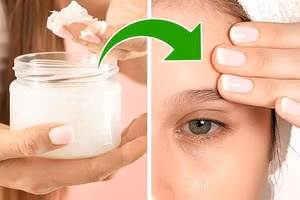 4 nguyên liệu tự nhiên giúp xóa mờ nếp nhăn trán