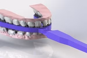 Cách sử dụng bàn chải chống sâu răng cho trẻ em. 