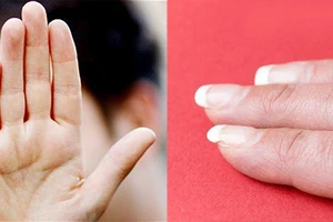 4 vùng có màu trắng báo hiệu cơ thể suy yếu, dễ đau ốm bệnh tật