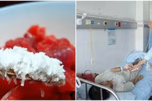 7 loại thức ăn rất kỵ mì chính, tuyệt đối không thêm vào