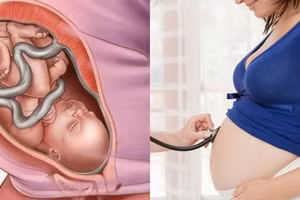 Ảnh minh họa/INT.