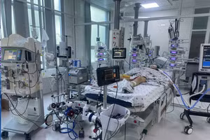 Bé gái vừa được can thiệp ECMO, thở máy, vừa lọc máu liên tục. (Ảnh: BVCC).