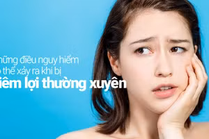 Nhiều điều nguy hiểm có thể xảy ra khi bị viêm lợi thường xuyê