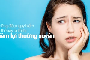 Nhiều điều nguy hiểm có thể xảy ra khi bị viêm lợi thường xuyê