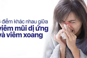 Viêm mũi dị ứng và viêm xoang thường bị nhầm lẫn