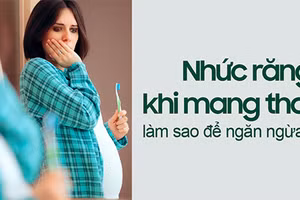 Một số chị em bị nhức răng khi mang thai