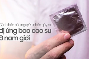 Cảnh báo các nguyên nhân gây ra dị ứng bao cao su ở nam giới