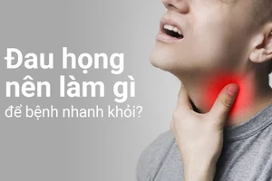 Giải đáp thắc mắc "Đau họng nên làm gì để bệnh nhanh khỏi?"