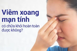 Viêm xoang mạn tính có chữa khỏi được không?