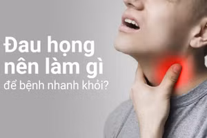 Giải đáp thắc mắc "Đau họng nên làm gì để bệnh nhanh khỏi?"