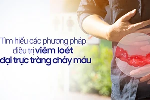 Viêm loét đại trực tràng chảy máu là bệnh lý nguy hiểm và đang có xu hướng gia tăng