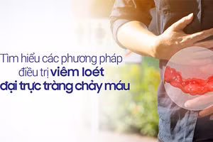 Viêm loét đại trực tràng chảy máu là bệnh lý nguy hiểm và đang có xu hướng gia tăng