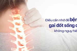 Những lưu ý dành cho người bị gai đốt sống cổ