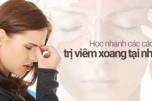 Có nhiều cách trị viêm xoang tại nhà hiệu quả