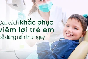 Viêm lợi trẻ em cần điều trị kịp thời để tránh sâu răng, mất răng