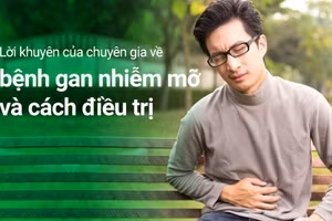 Gan nhiễm mỡ là tình trạng mỡ tích trữ trong gan quá nhiều