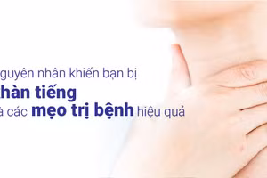 Khàn tiếng là khi dây thanh quản bị tổn thương 