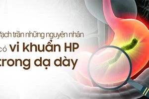 "Vạch trần" những nguyên nhân có vi khuẩn HP trong dạ dày